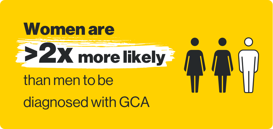 Women are 2 times more likely than men to be diagnosed with GCA
