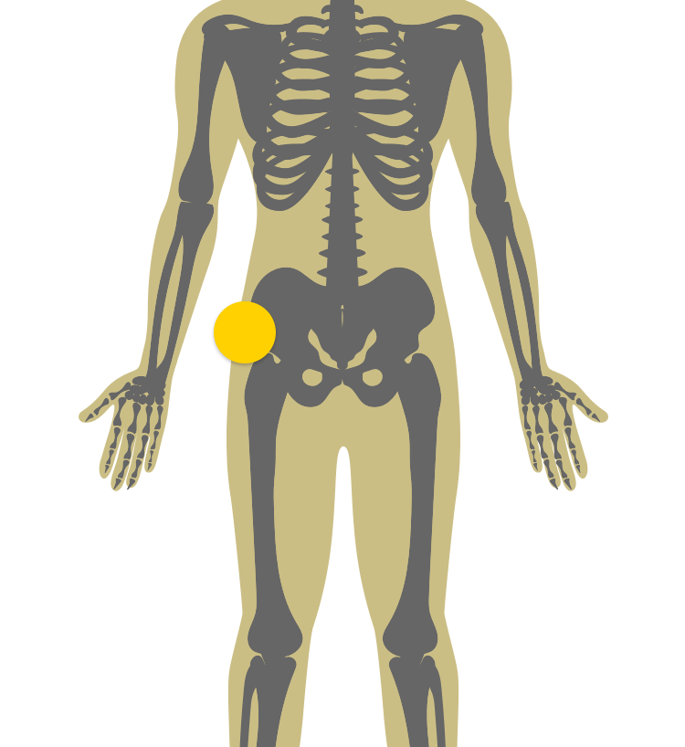 Illustration of upper part of body indicating reduced physical mobility