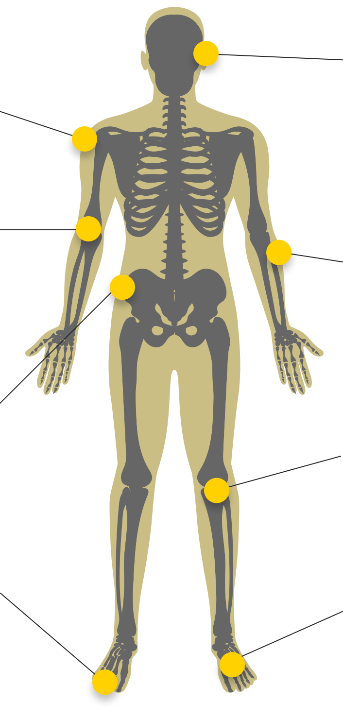 Illustration of a body showing the skeleton within