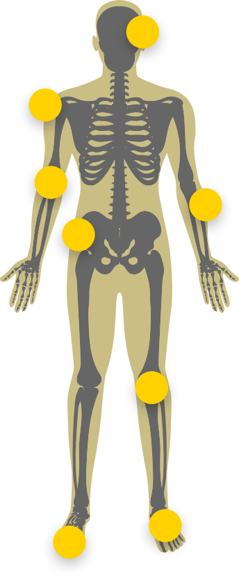 Illustration of a body showing the skeleton within