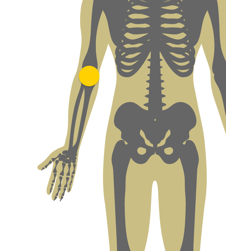 Illustration of body indicating joint stiffness