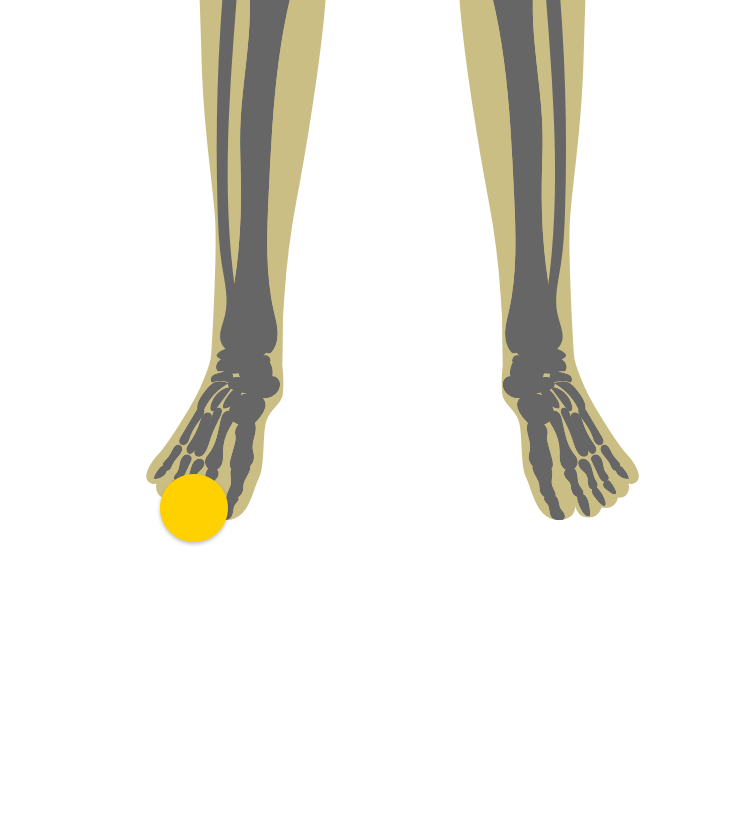 Illustration of lower legs and feet indicating swelling & pain of fingers or toes.