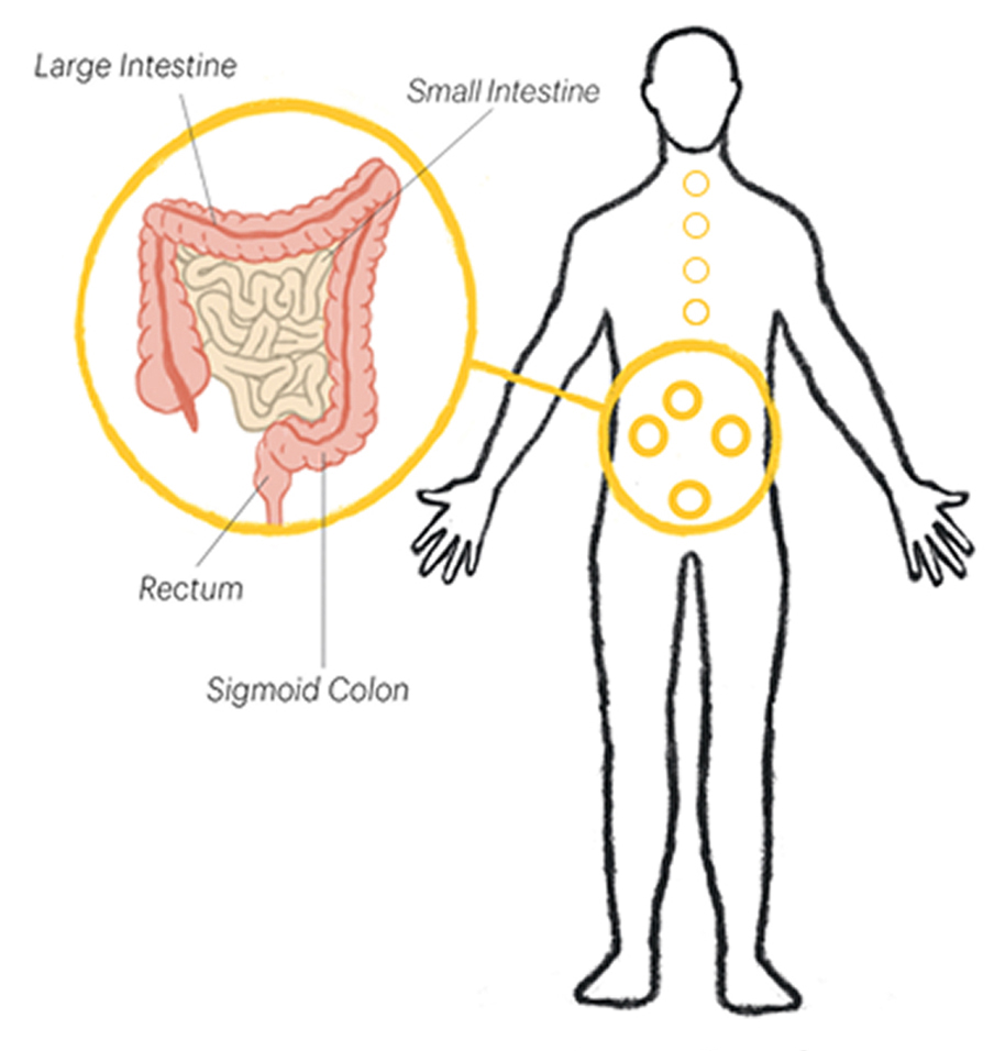 Body outline with large intestine, rectum, and sigmoid colon highlighted