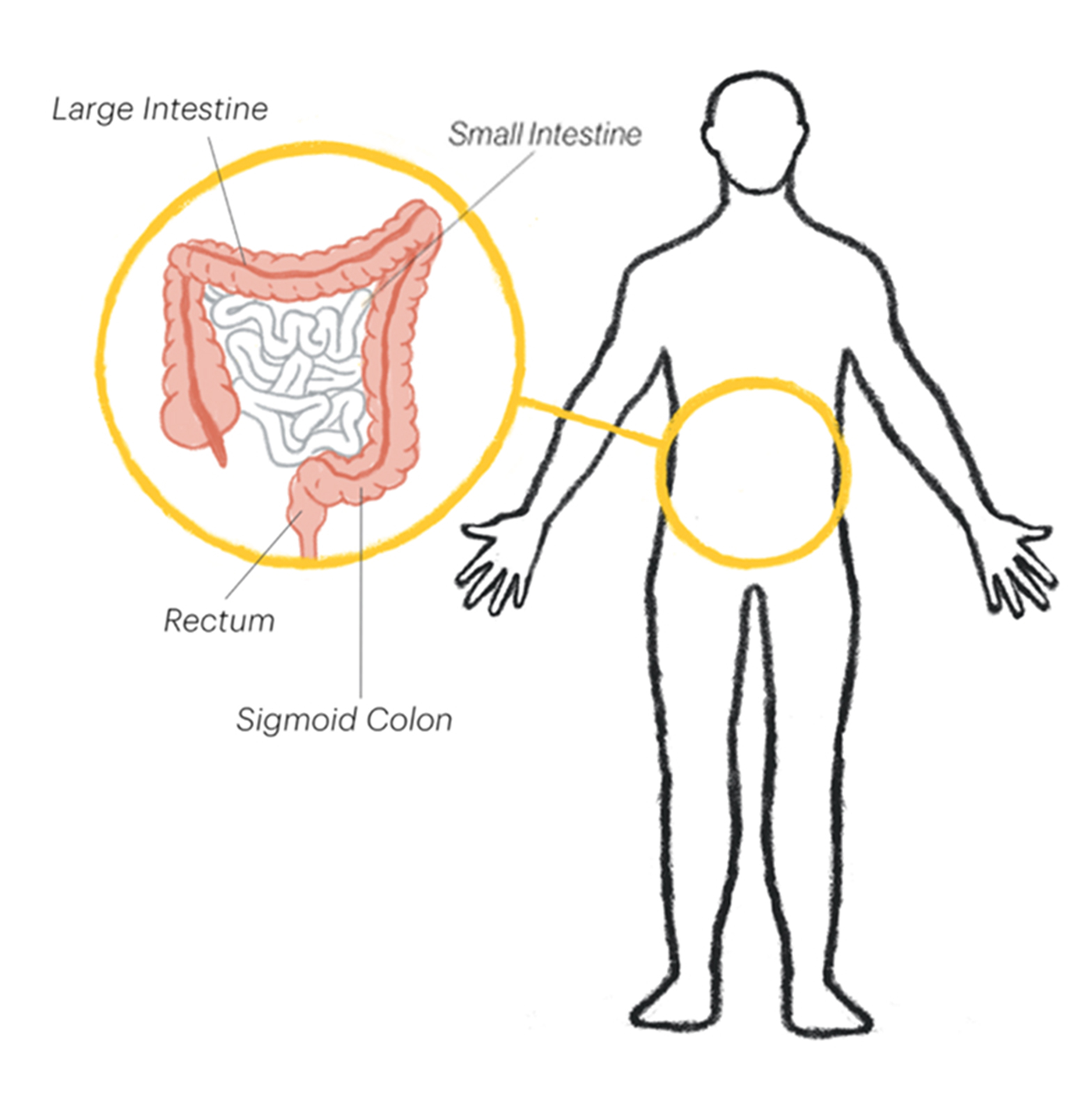 Body outline with large intestine, rectum, and sigmoid colon highlighted