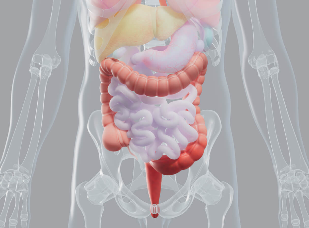 Diagram of a body with visible colon lining repair